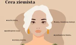 Ziemista cera jak wygląda - objawy, przyczyny i sposoby poprawy