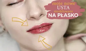Ile kwasu hialuronowego w usta? Odkryj idealną dawkę dla siebie
