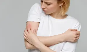 Kobieta z zaczerwienionym ramieniem, które swędzi, choć nie widać wyraźnych zmian skórnych.