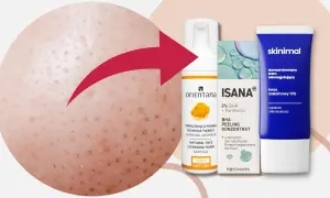 Skóra z widocznymi filamentami łojowymi, obok kosmetyki do pielęgnacji: pianka Orientana, peeling Isana i krem Skinimal.