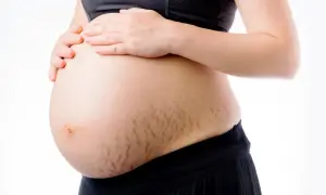 Brzuch ciężarnej kobiety z widocznymi rozstępami. Delikatne linie na skórze świadczą o przemianach zachodzących w ciele.