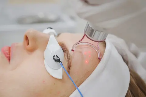 Laser frakcyjny czy boli? Oczekiwany ból i sposób na jego złagodzenie