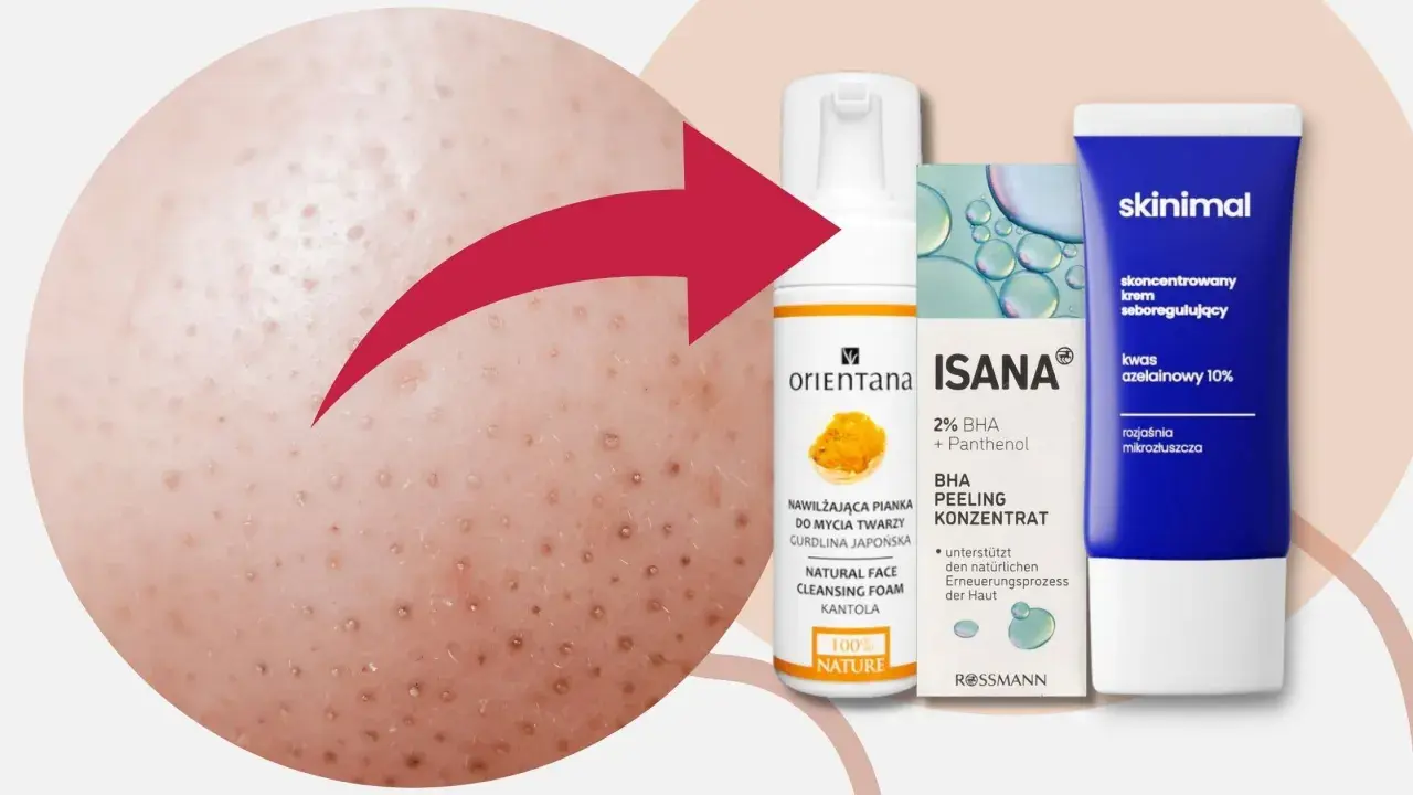 Skóra z widocznymi filamentami łojowymi, obok kosmetyki do pielęgnacji: pianka Orientana, peeling Isana i krem Skinimal.