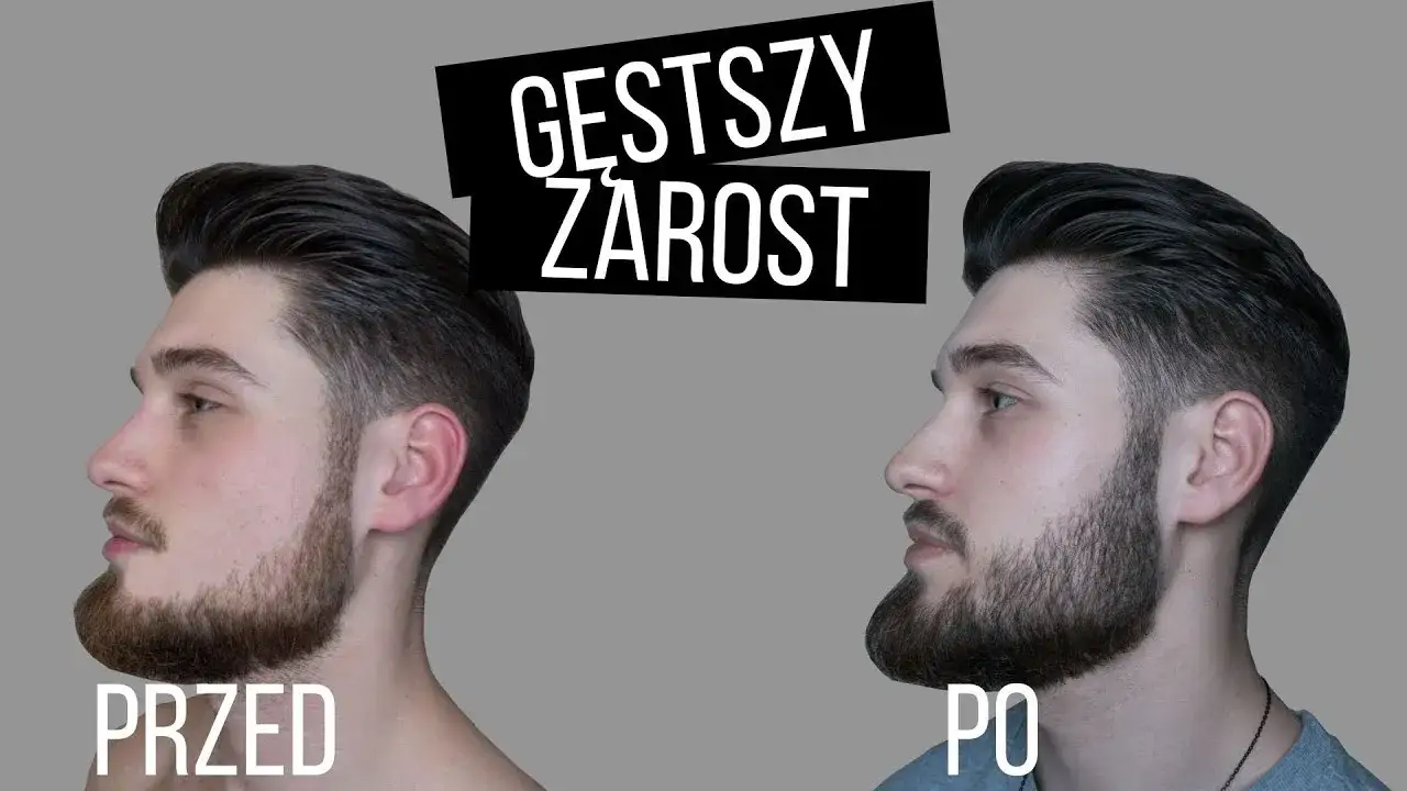 Zdjęcie Jak zapuścić brodę przy słabym zaroście - skuteczne sposoby na gęstość